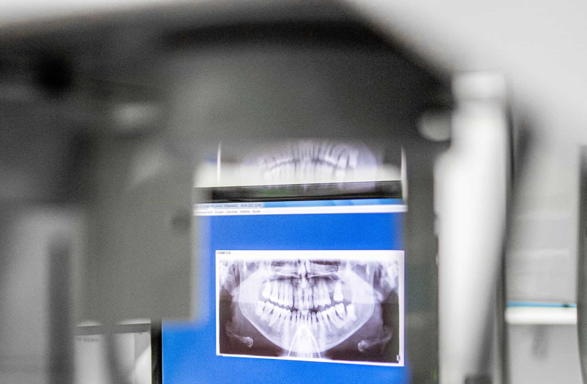 Periodoncia Periodoncia
