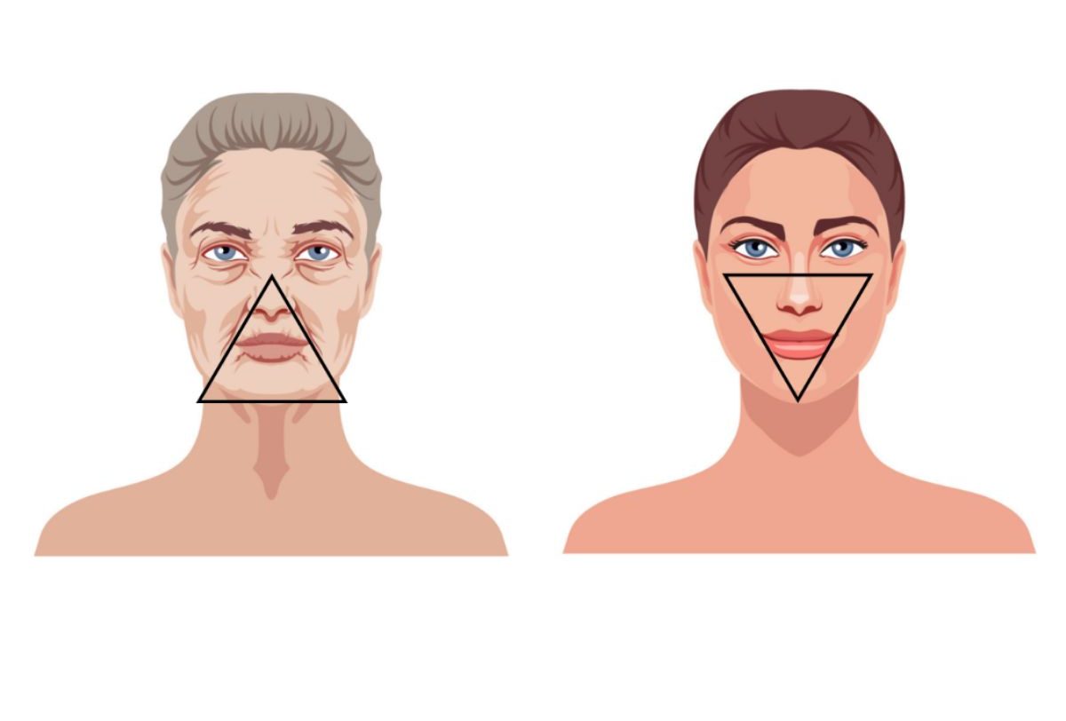 Forma de V vs Forma de A