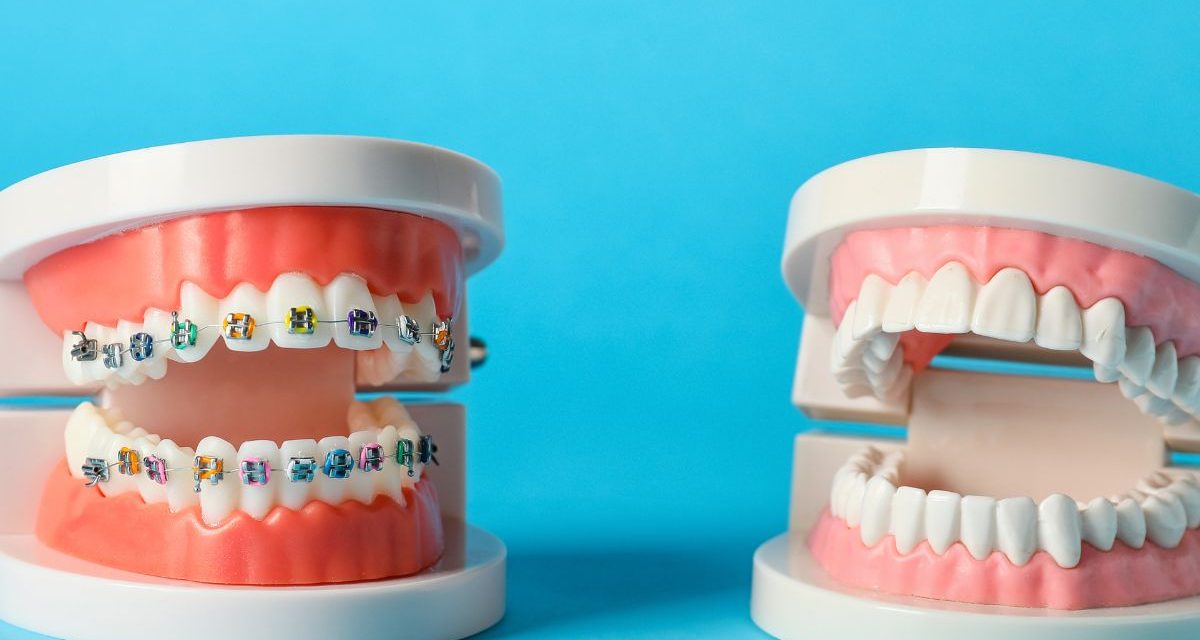 Ortodoncia: mucho más que estética
